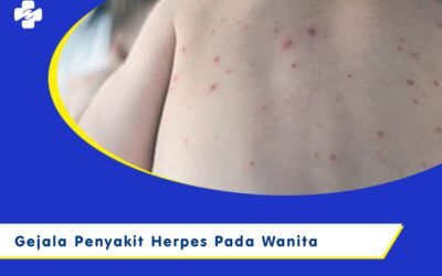 Gejala Penyakit Herpes Pada Wanita